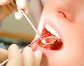 Close-up of patients open mouth before oral inspection with hook and mirror near by